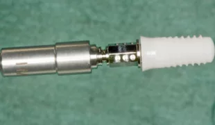 Abb. 1: Das Straumann® PURE Ceramic Implantat.