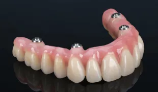 Permadental erwartet Anstieg von Implantat-Versorgungen für zahnlose Kiefer.