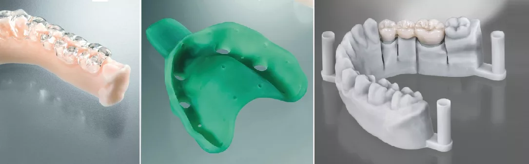 3D-Drucks im Dentallabor.