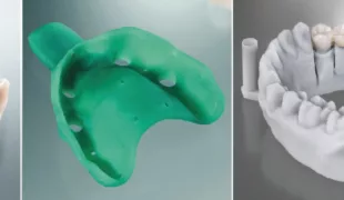 3D-Drucks im Dentallabor.