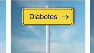 Indirekter Einfluss von Adipositas auf Parodontitis über Diabetes mellitus.