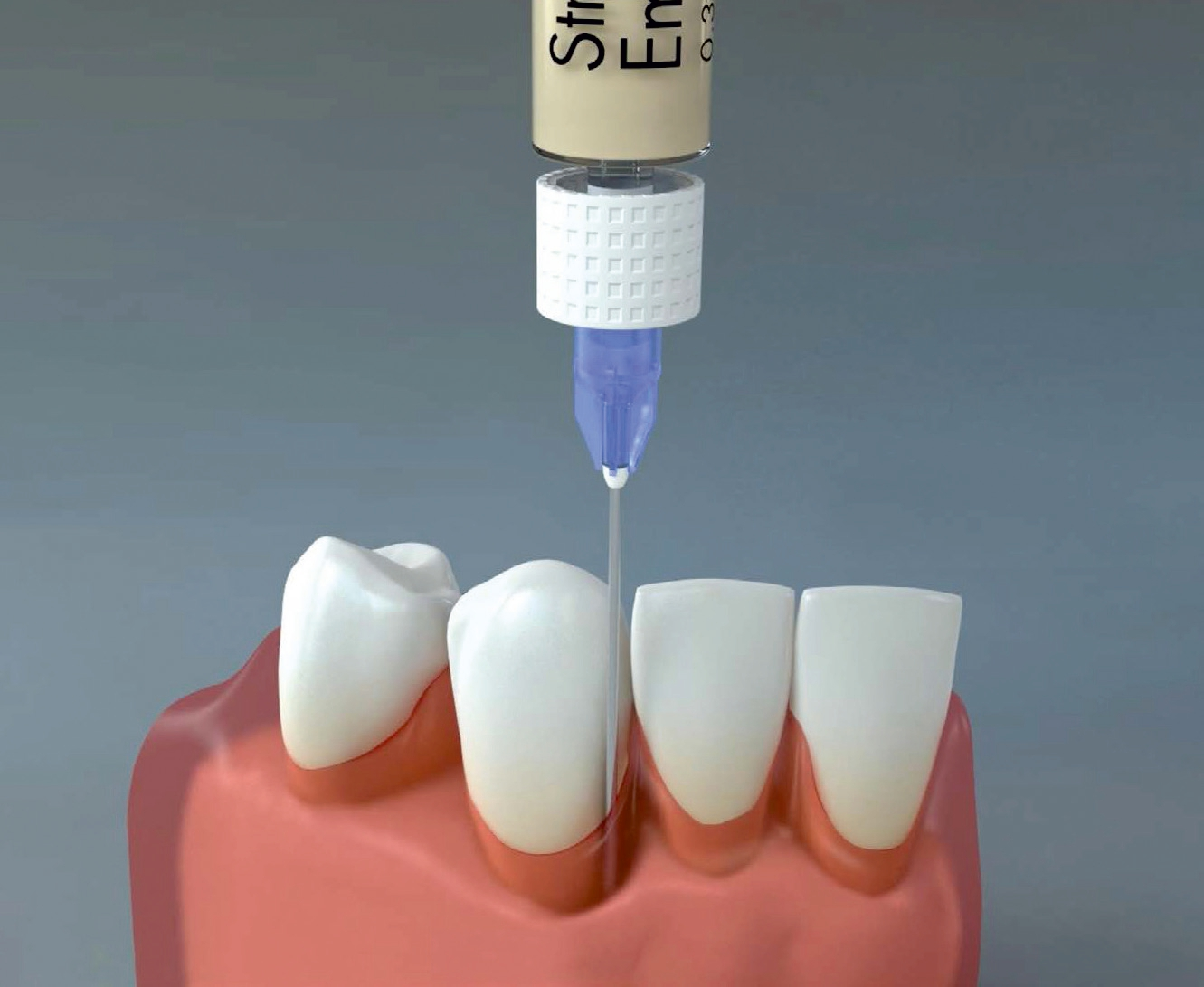 Straumann Emdogain®.