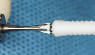 Keramikimplantat.