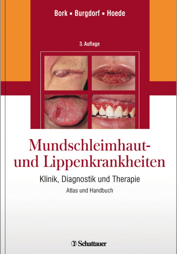 „Mundschleimhaut- und Lippenkrankheiten ? Klinik, Diagnostik und Therapie“.