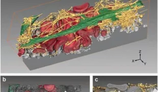 3D-Modelle der Interaktion von hMSCs mit einem auf einer alkalisch behandelten Ti-Oberfläche (=INICELL) haftenden Blutkoagulum zeigen die feste Verankerung von Matrixfasern auf der Ti-Oberfläche.