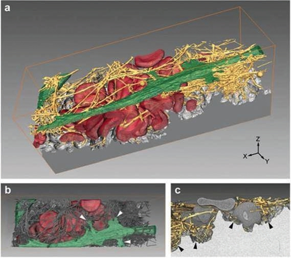 3D-Modelle der Interaktion von hMSCs mit einem auf einer alkalisch behandelten Ti-Oberfläche (=INICELL) haftenden Blutkoagulum zeigen die feste Verankerung von Matrixfasern auf der Ti-Oberfläche.