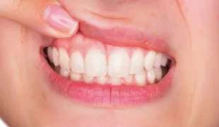 © Stefano Garau/fotolia