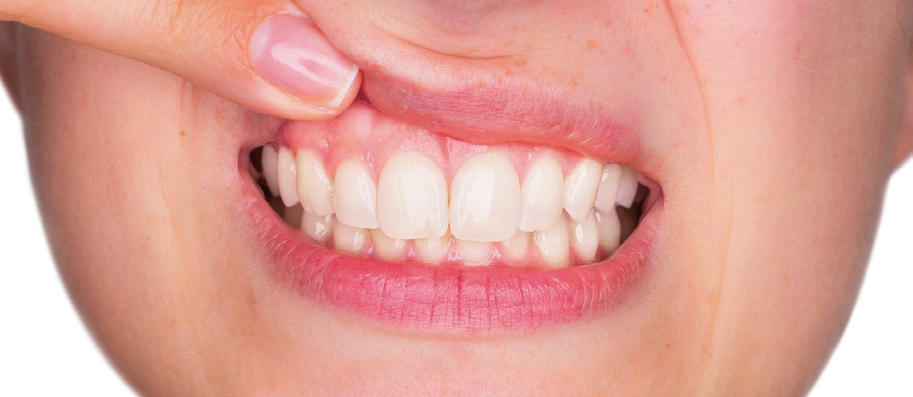 © Stefano Garau/fotolia