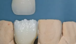 Farbkontrolle nach dem Vorbereitungsbrand.