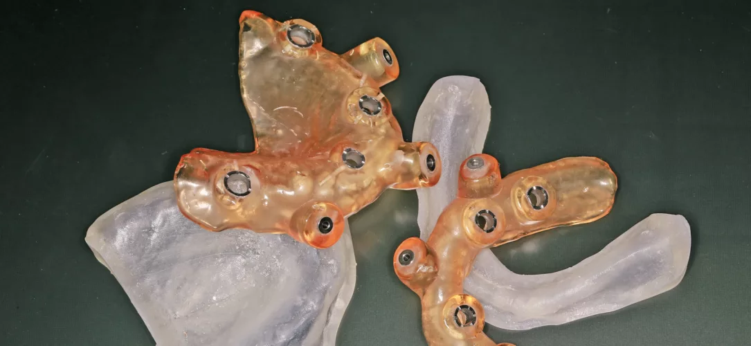 Die Schablonen wurden nach Vorgabe der Planung geliefert.