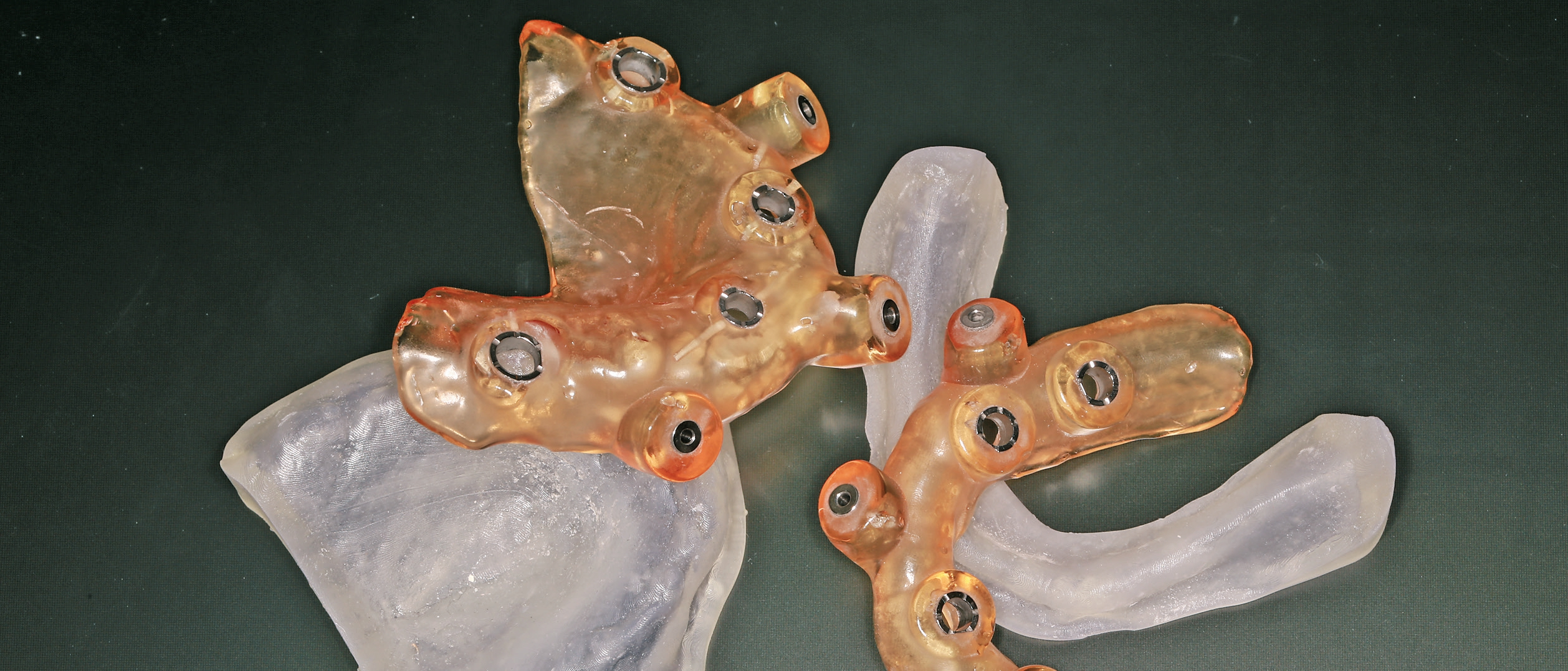 Die Schablonen wurden nach Vorgabe der Planung geliefert.