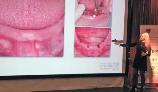 Dr. Melanie Grebe aus Dortmund bei ihrem Vortrag zum Hahn Implantat.