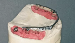 Der Steg wurde durchtrennt.