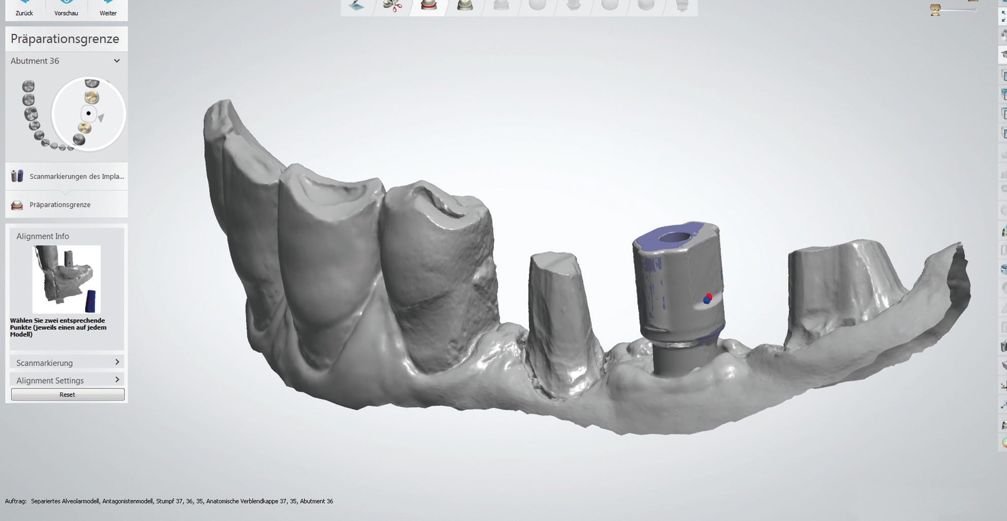 Abb. 1: Digitales Modell auf Basis eines Intraoralscans.