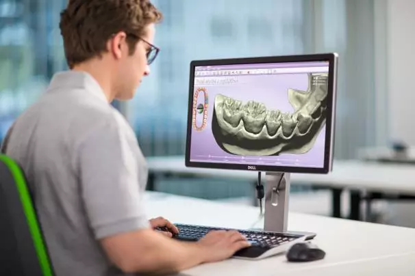 CAD-Software bietet immer mehr Möglichkeiten: Die Webinare von Kulzer helfen Anwendern, noch mehr Funktionen effizient zu nutzen.