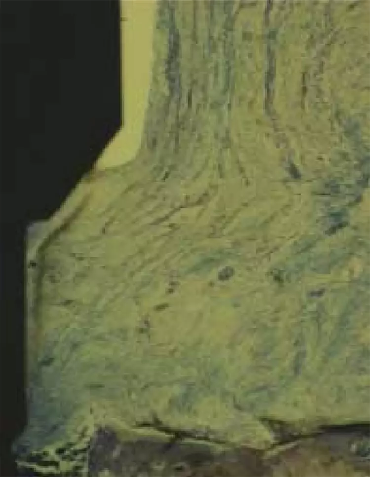 Abb. 1: Andocken von bindegewebigen hemdesmosomalen
Fasern an Abutmentunterseite
(Mennerich 2002).