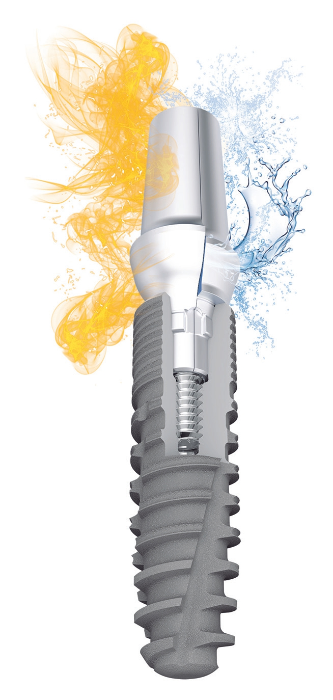 ABUTMENT SWITCH: 1 Implantat – 2 Anschlussgeometrien – conical oder platform.