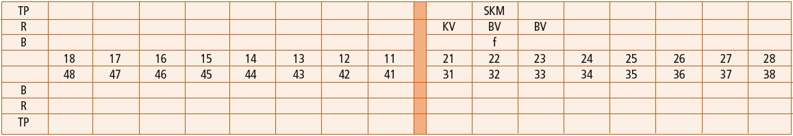 Abb. 1: Erläuterungen: TP = Therapieplan, R = Wurzelstiftkappe, B = Brückenglied, f = fehlender Zahn, KV = Krone mit vestibulärer Verblendung, BV = Brückenglied mit vestibulärer Verblendung, SKM = Suprakonstruktion Krone vollkeramisch oder keramisch voll verblendet.