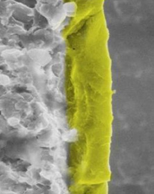Abb. 1: Cerid®-Keramik-Coating von Titan in einer Schichtstärke von 2–5 ?m. Dieses Verfahren wird bereits seit vielen Jahren in anderen medizinischen Technologiebereichen (z. B. Hüft- oder Endoprothetik, Gefäßchirurgie, Wirbelsäulenimplantologie erfolgreich angewandt. (Bildnachweis: Fa. Impreglon)