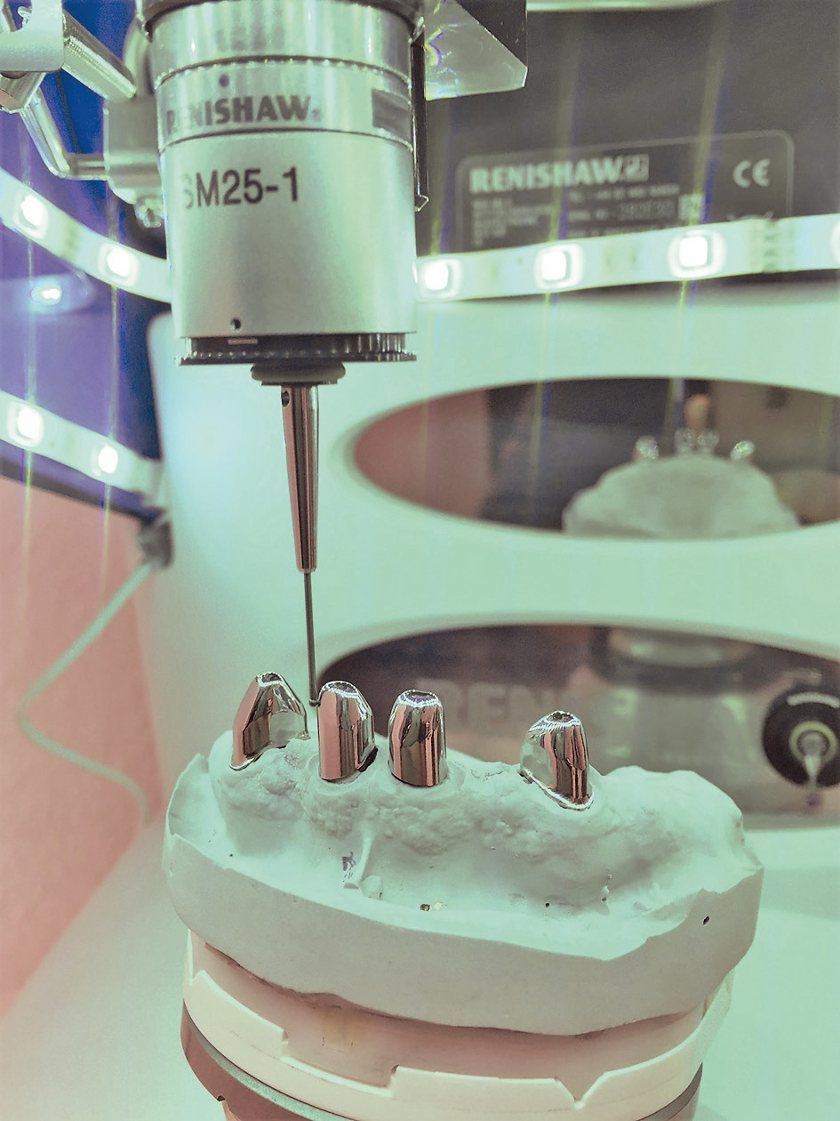 Abb. 1a: Taktiler Positionsscan auf dem Meistermodell. Zum Renishaw-Scanner gehört ein individuell einstellbarer Tisch, der die exakte Positionsübertragung erlaubt.