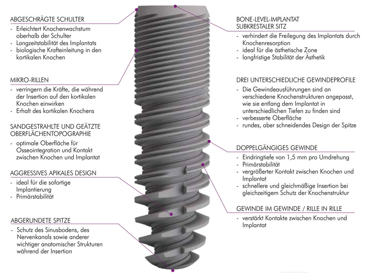 Abb. 1: Konstruktionsprinzipien des C-Tech EL Implantatsystems (Abbildung vom Hersteller zur Verfügung gestellt).