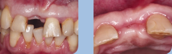 Abb. 1 u. 2: Klinische Ausgangssituation.