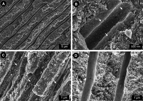 Abb. 1: Rasterelektronenmikroskopische Aufnahmen der Feinstruktur von Dentin in permanenten Zähnen (A–C) und Milchzähnen (D). (A) Dentinmatrix aus einer Mischung von organischen Molekülen und Hydroxylapatit-Kristalliten, durchzogen von regelmäßig angeordneten Dentintubuli mit Durchmessern von ca. 1 ?m im Längsbruch (6.000-fach vergrößert). (B) Tubuli in peripheren Dentinbereichen sind in der Regel durch starke Ablagerungen von Mineralpartikeln an den Wänden verengt (Pfeile, 45.000-fach vergrößert). (C) Die Wände von Tubuli im basalen Bereich sind häufig mit Kollagenfasern ausgekleidet (Pfeile, 25.000-fach vergrößert). (D) Tubuli im Dentin von Milchzähnen sind oft von einer dünnen organischen Schicht ausgekleidet und zeigen in der Regel keine mineralischen Ablagerungen an den Wänden (20.000-fach vergrößert).