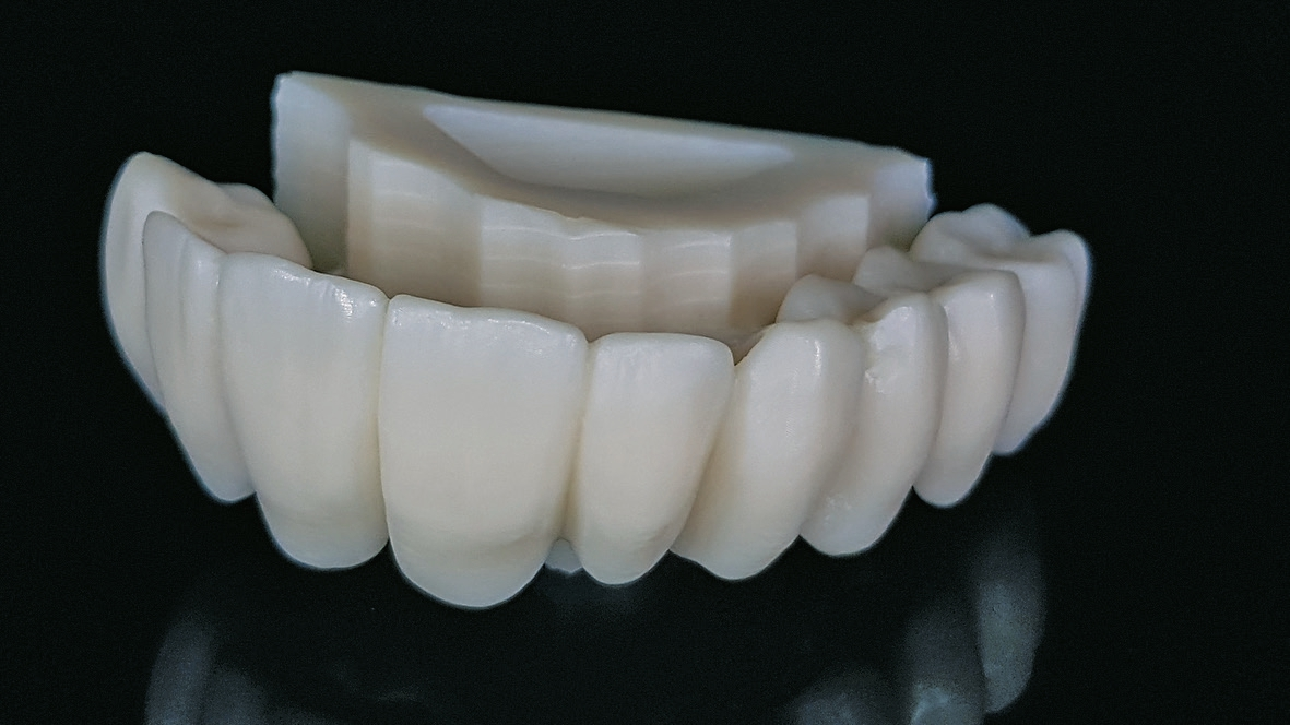 Abb. 1: Mittlerweile ein wichtiger Bestandteil des Tagesgeschäfts bei Dental-Art-Specialists: größere Implantatarbeiten aus Cercon ht mit True Color Technology. Die Suprakonstruktion wurde aus dem Rohling herausgefräst und anschließend gesintert – eine Nacharbeit ist oft nicht erforderlich.