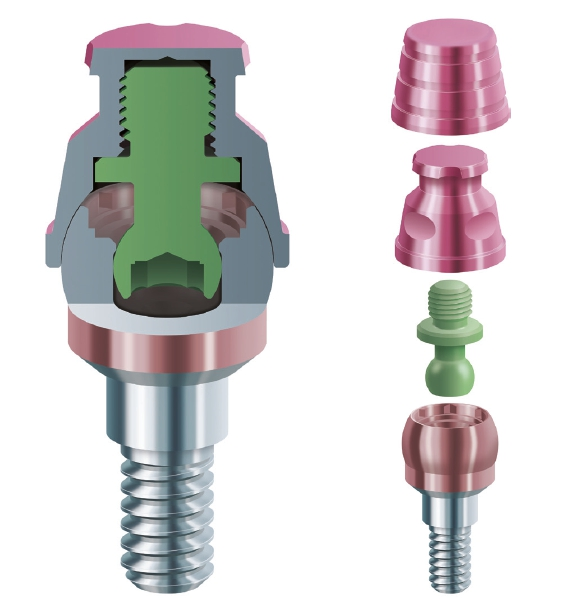 Abb. 1: Das dreiteilige Attachementsystem, bestehend aus dem Matrizengehäuse, dem kugelförmiges PEEK-Attachement und dem Abutment.