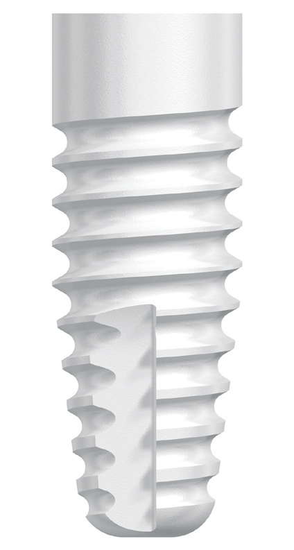 Das neue Keramikimplantat NobelPearl von Nobel Biocare.