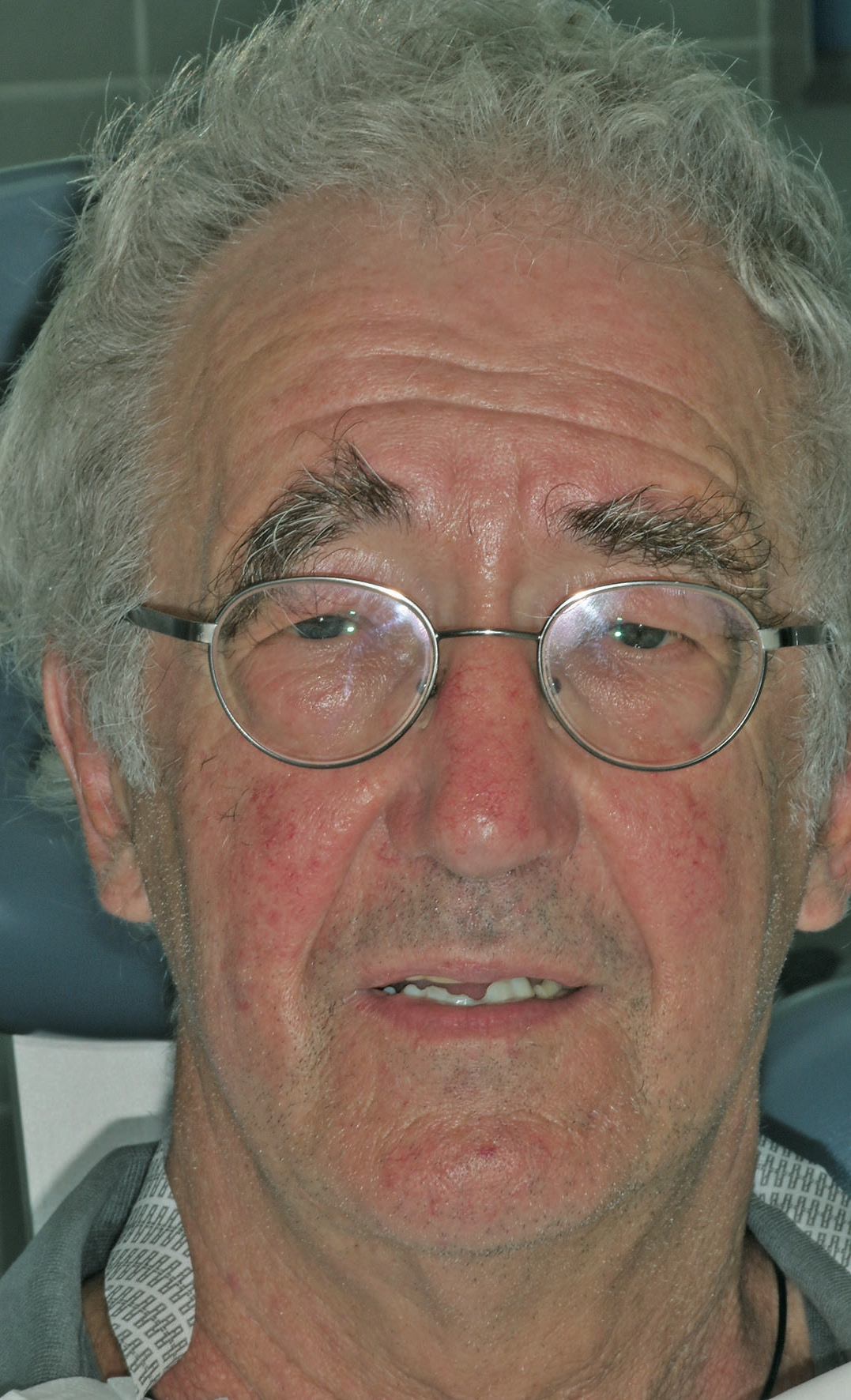 Abb. 1: Patient vor der Behandlung.