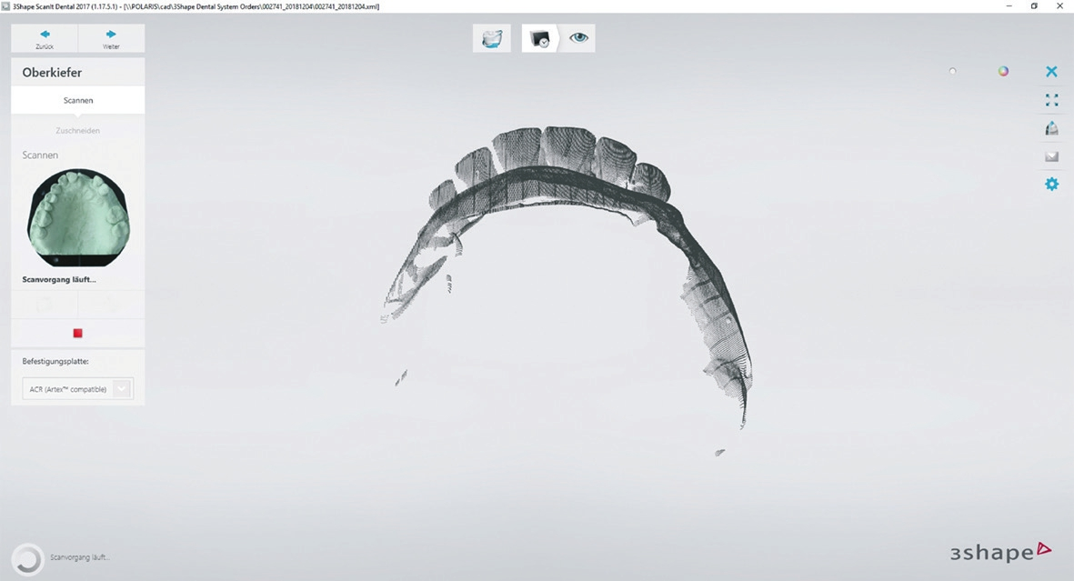 Abb. 1: Die physischen Modelle werden mit dem 3Shape D1000 Desktopscanner digitalisiert.