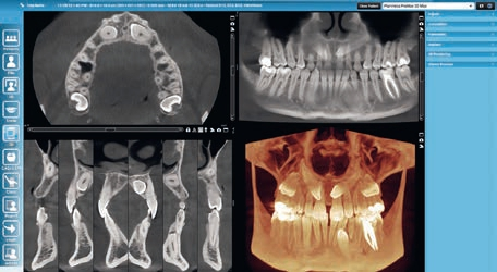 Abb. 1: Den vollen Durchblick: Mit dem 3D-Bildgebungsmodul schafft die Planmeca Romexis hervorragende Voraussetzungen für Diagnose und Behandlungsplanung.