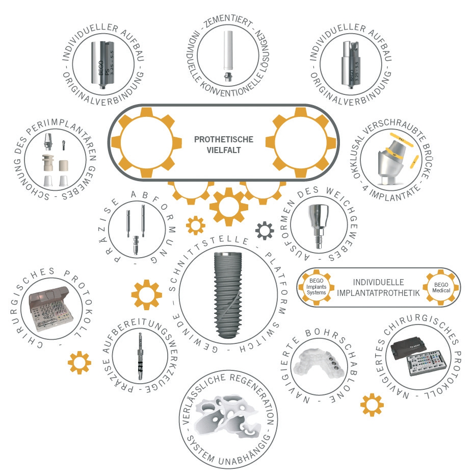 Abb. 1: In einem Implantatsystem sind alle Komponenten aufeinander abgestimmt.