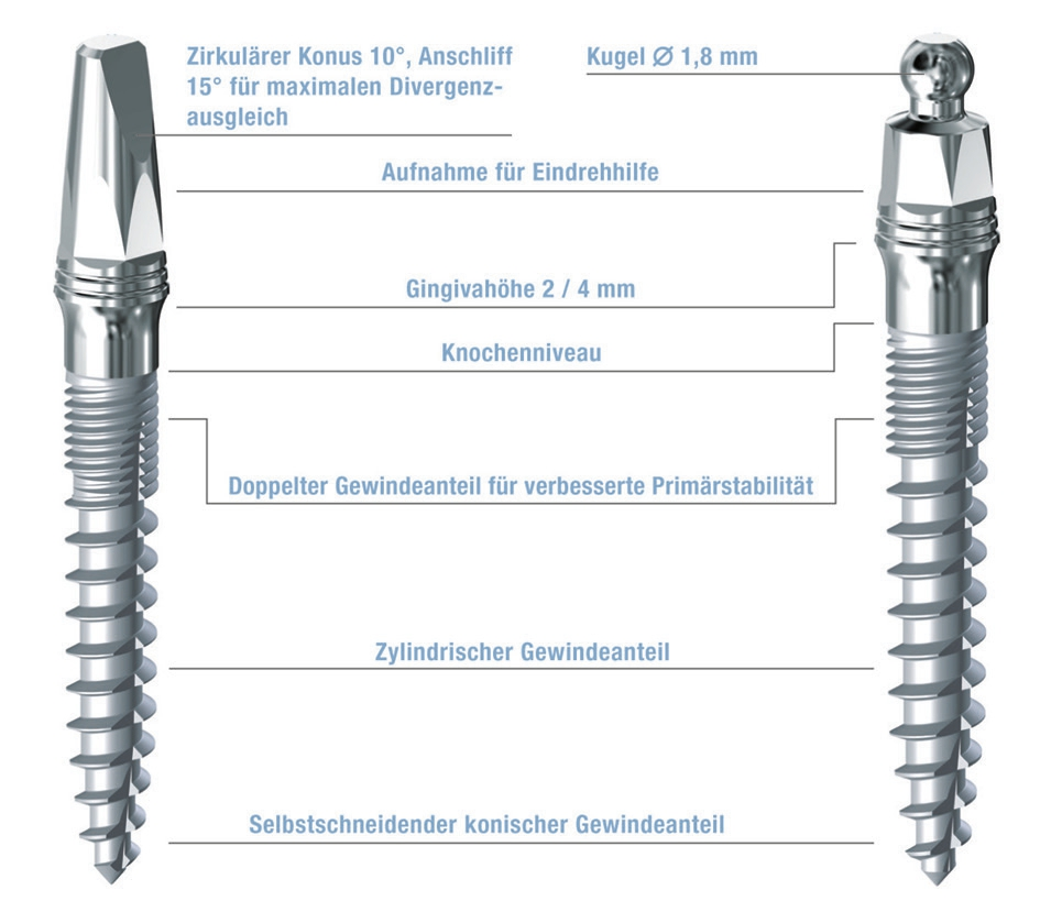 Abb. 1: Trias® Mini-post mit Konus und Trias® Mini-ball mit Kugelkopf von m&k.