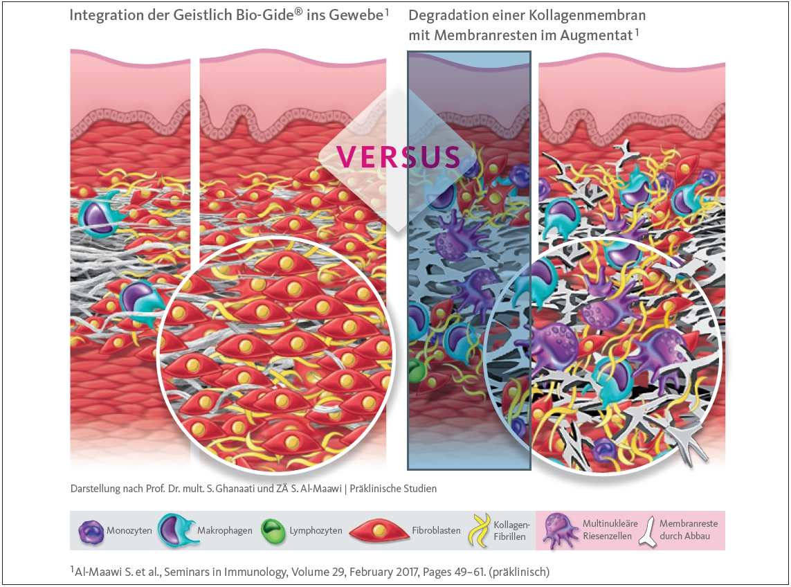 Schematische Gegenüberstellung der Integrations- und Degradationsmuster nach Prof. Dr. mult. S. Ghanaati und ZÄ S. Al-Maawi (Präklinische Studien).