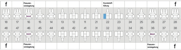 Abb. 1: Der dentale Befund.