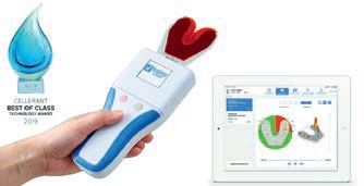 Das OccluSense®-System.