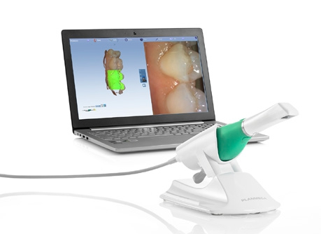 Intraoralscanner zeigen sich in Verbindung mit einer leistungsfähigen Software immer stärker in puncto „Kommunikation“ – gegenüber dem Patienten, innerhalb des eigenen Teams und beim Austausch mit externen Kollegen.