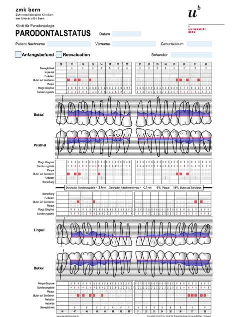 Abb. 1: Parodontalstatus und Bleeding on Probing (BOP) vor Therapiebeginn.