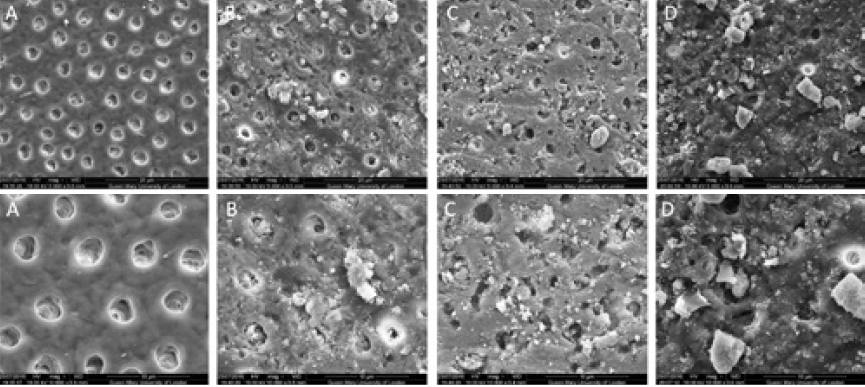 Abb. 1: REM-Bilder von 3 Dentinoberflächen nach Behandlung mit BioMin F Zahnpasta; oben 5.000 x vergrößert; unten 10.000 x vergrößert (A) Aufnahme Ausgangsphase; (B) Nach dem Bürsten mit BioMin F; (C) Nach dem Bürsten mit BioMin F und dem Eintauchen für 1 Stunde in künstlichem Speichel; (D) Nach dem Bürsten mit BioMin F und nach Säureexposition (6% Zitronensäure)