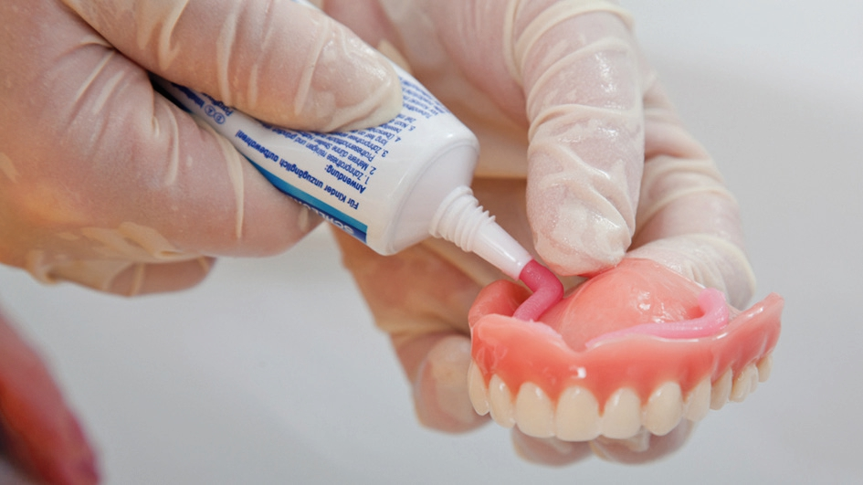 Mit Mini-Implantaten heißt es „Haftcreme adé!“ (Bildquelle: proDente e.V.).