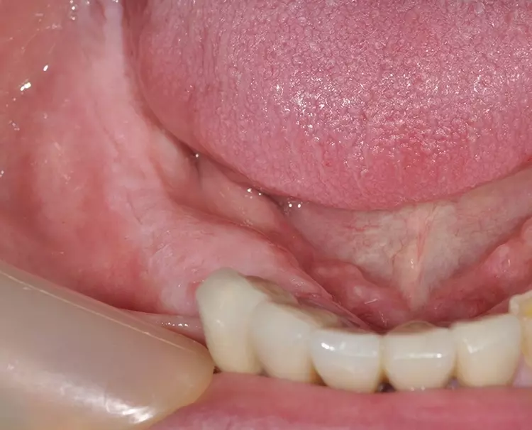 Abb. 2: Klinische Ausgangssituation.