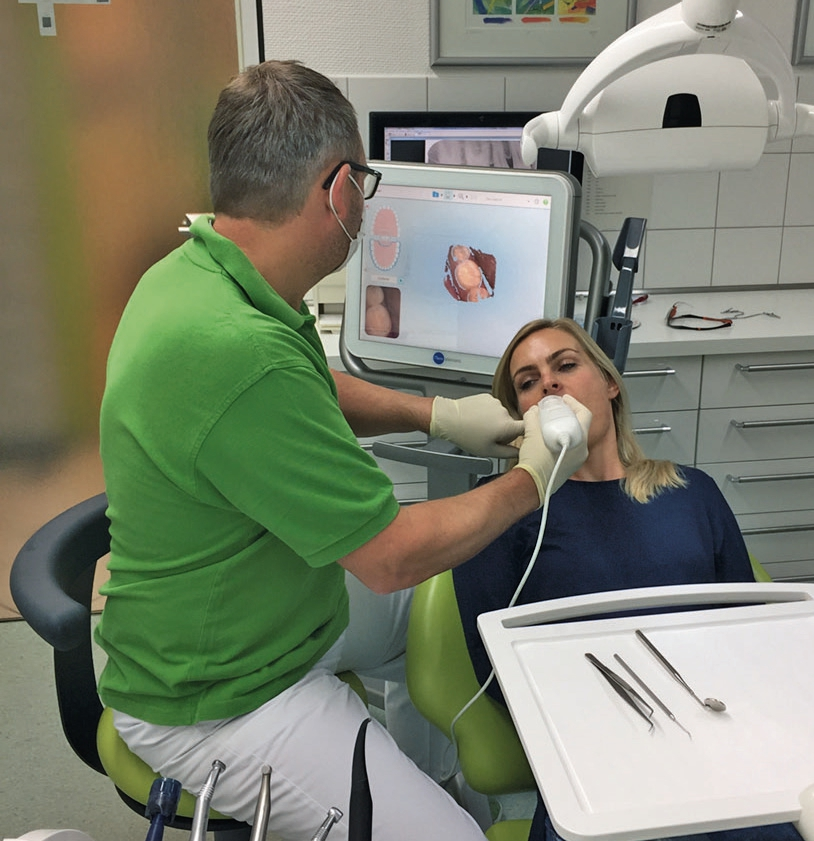 Abb. 2: Intraoralscan einer Patientin mit sofortiger Kontrolle am Bildschirm des Stehelements.