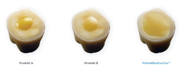 Abb. 2: An alle Dentalsubstrate angepasst: Ein einzelner Tropfen Prime & Bond active wurde mit einem Applikatortip ohne weitere Verarbeitung auf die Oberfläche aufgetragen. Er breitet sich von selbst („aktiv“) über den größten Teil der Fläche aus.