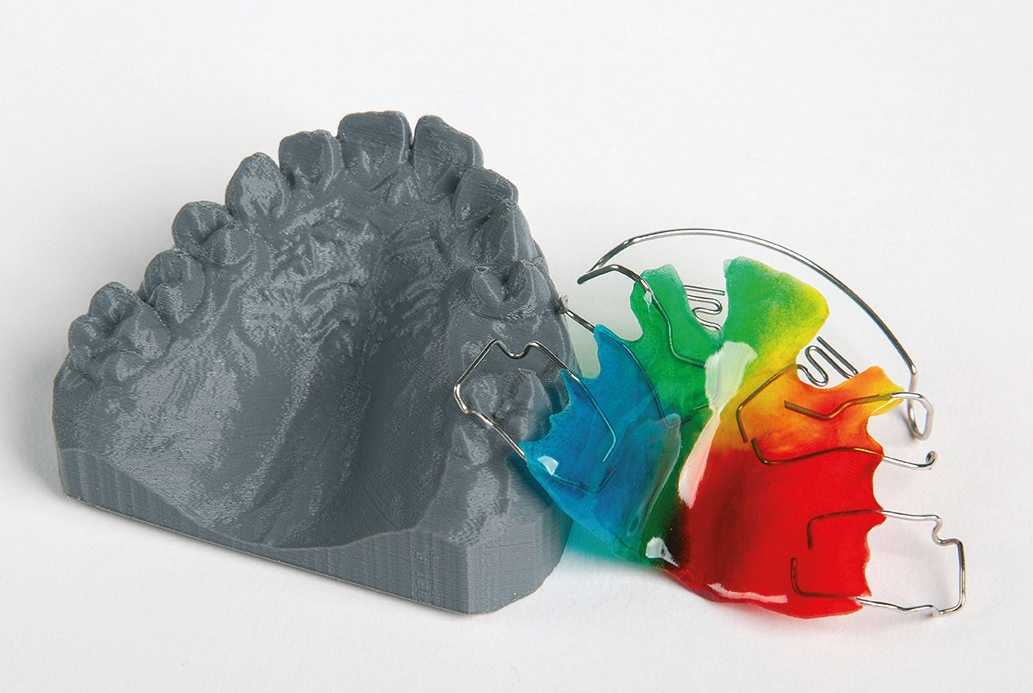 Abb. 2: Das Filament OrthoFill geht keine chemische Verbindung zu Acrylaten ein, sodass die KFO-Apparatur unverzüglich auf dem Modell hergestellt werden kann.