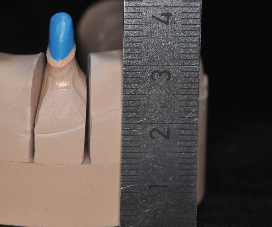 Abb. 2: Das Modell inklusive Sockel ist fast doppelt so hoch wie erforderlich, was zu größeren Auslenkungen führen kann, und dementsprechend können Passungsprobleme die Folge sein.