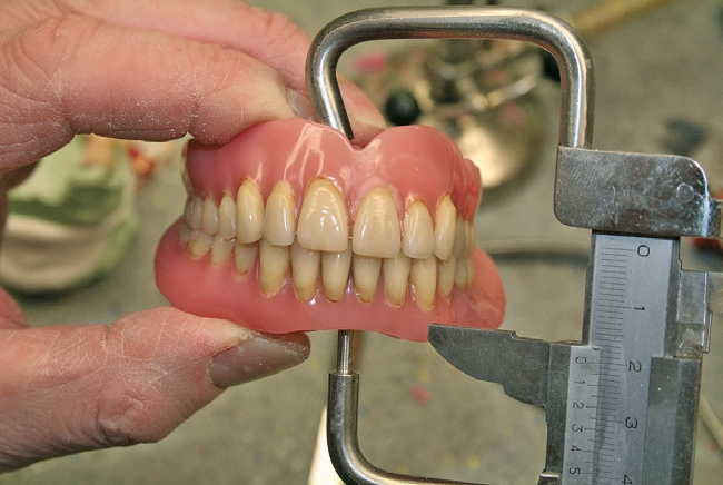 Abb. 2a: Direktes Bisshöhenmaß.