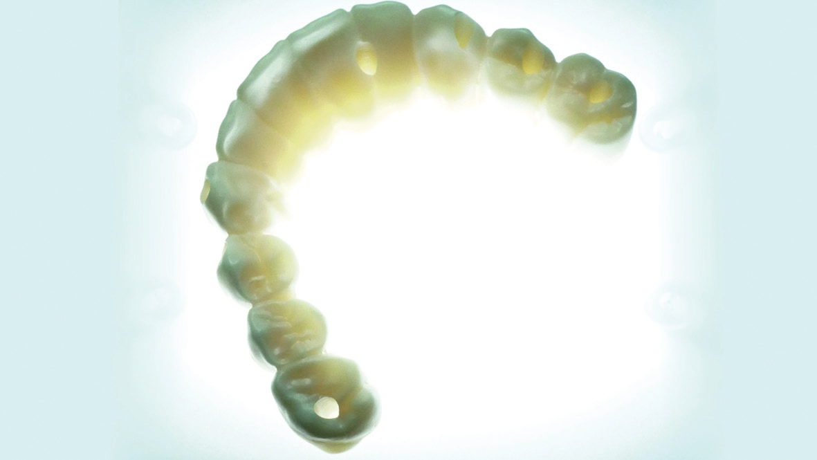 Abb. 2: Elfgliedrige Restauration zur direkten Verschraubung auf sieben Implantaten.