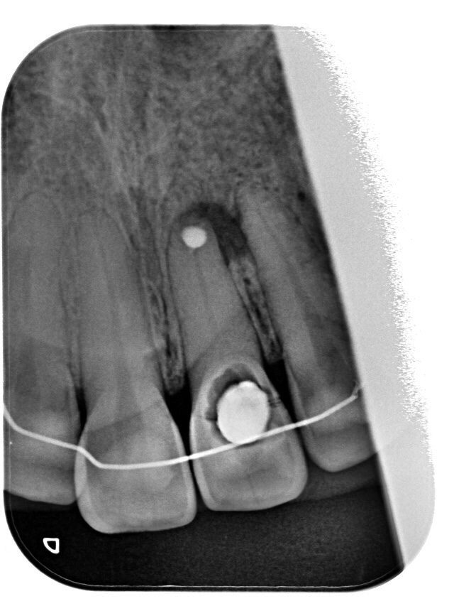 Abb. 10: Röntgenaufnahme.